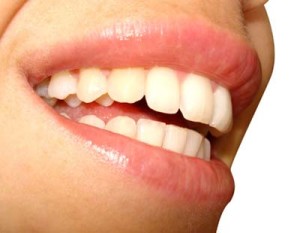 Imagem de Dentisteria Estética