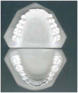 Imagem de molde dentário
