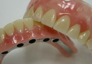 Imagem de prótese dentária